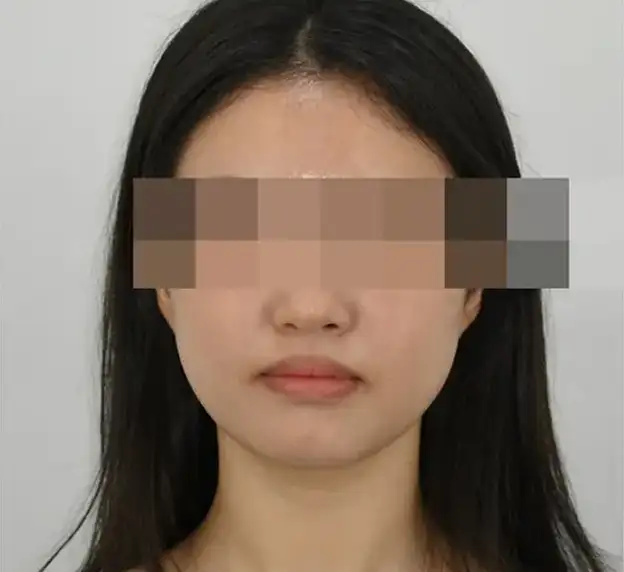 진짜 교정은 얼굴을 함께 보아야만 합니다.