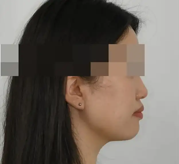 진짜 교정은 얼굴을 함께 보아야만 합니다.