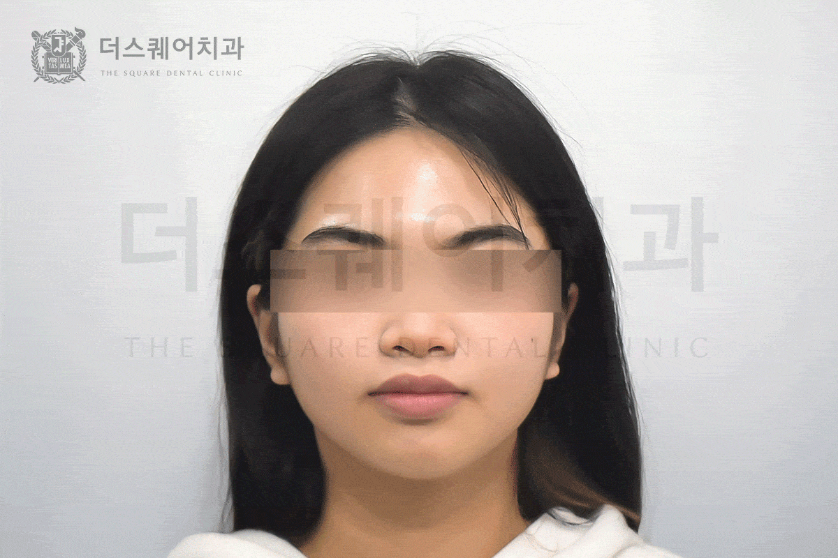 첫인상을 바꾸는 진짜 교정