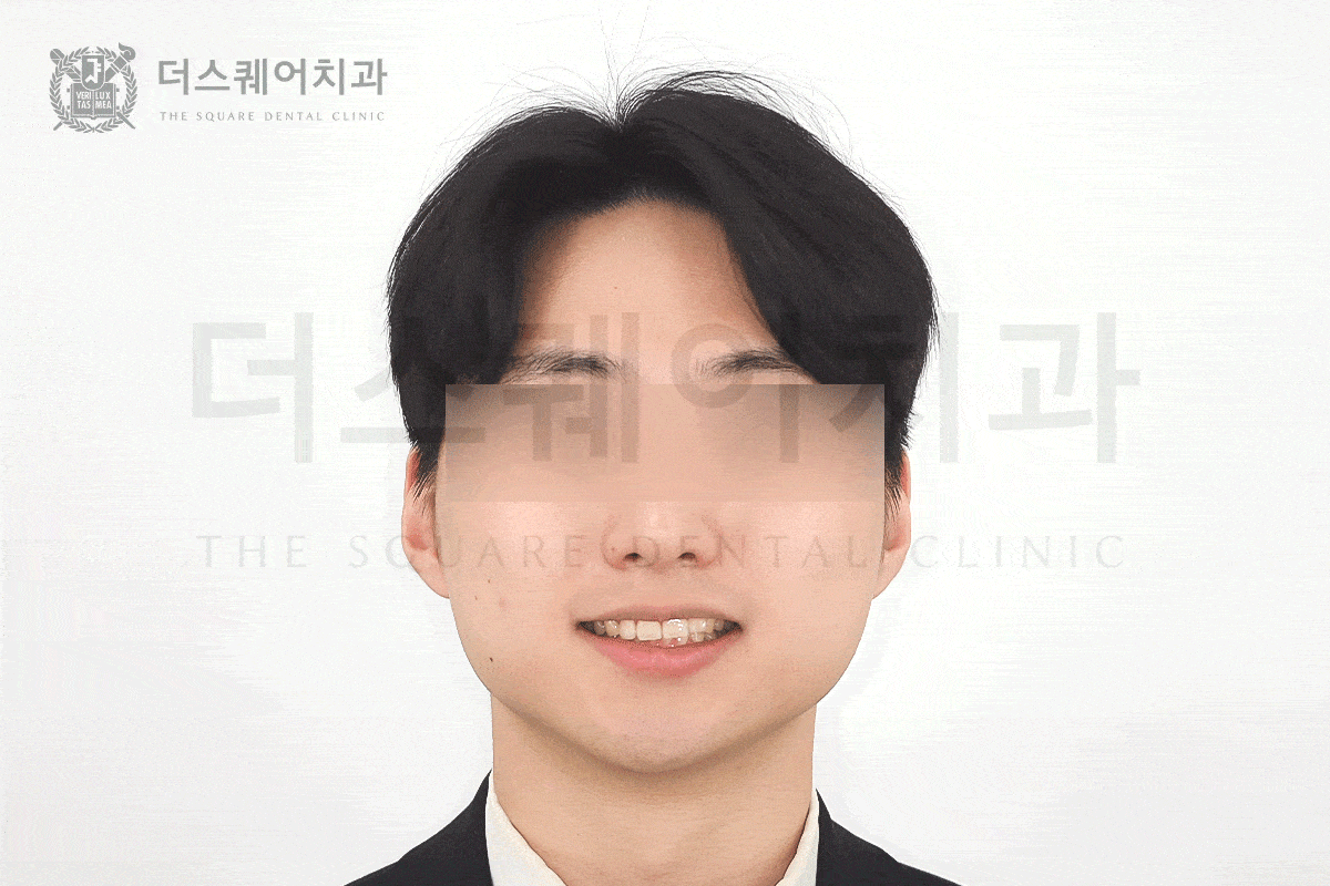 첫인상을 바꾸는 진짜 교정