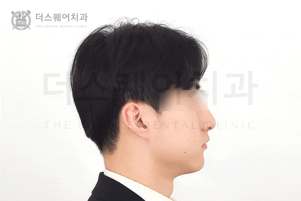 첫인상을 바꾸는 진짜 교정