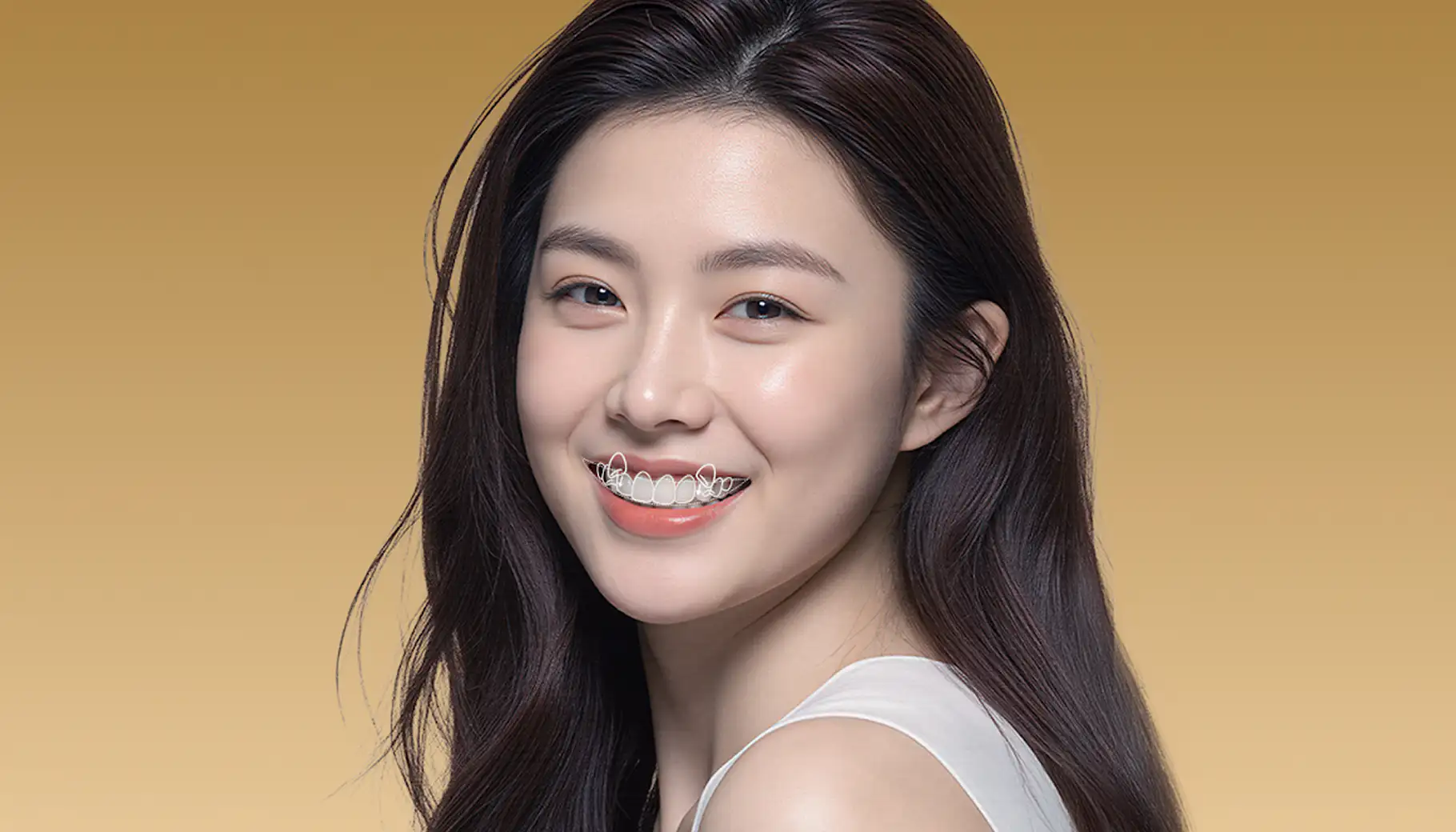 더스퀘어치과 복구치료 치아교정 증상별 치아교정 덧니 교정